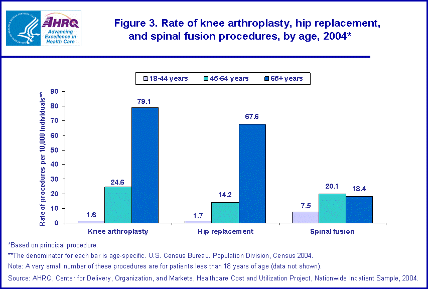 Figure 2. Bar chart showing rate of knee arthroplasty, hip replacement, and spinal fusion procedures, by age, 2004