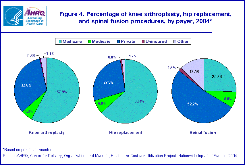 Figure 2. Bar chart showing percentage of knee arthroplasty, hip replacement, and spinal fusion procedures, by payer, 2004